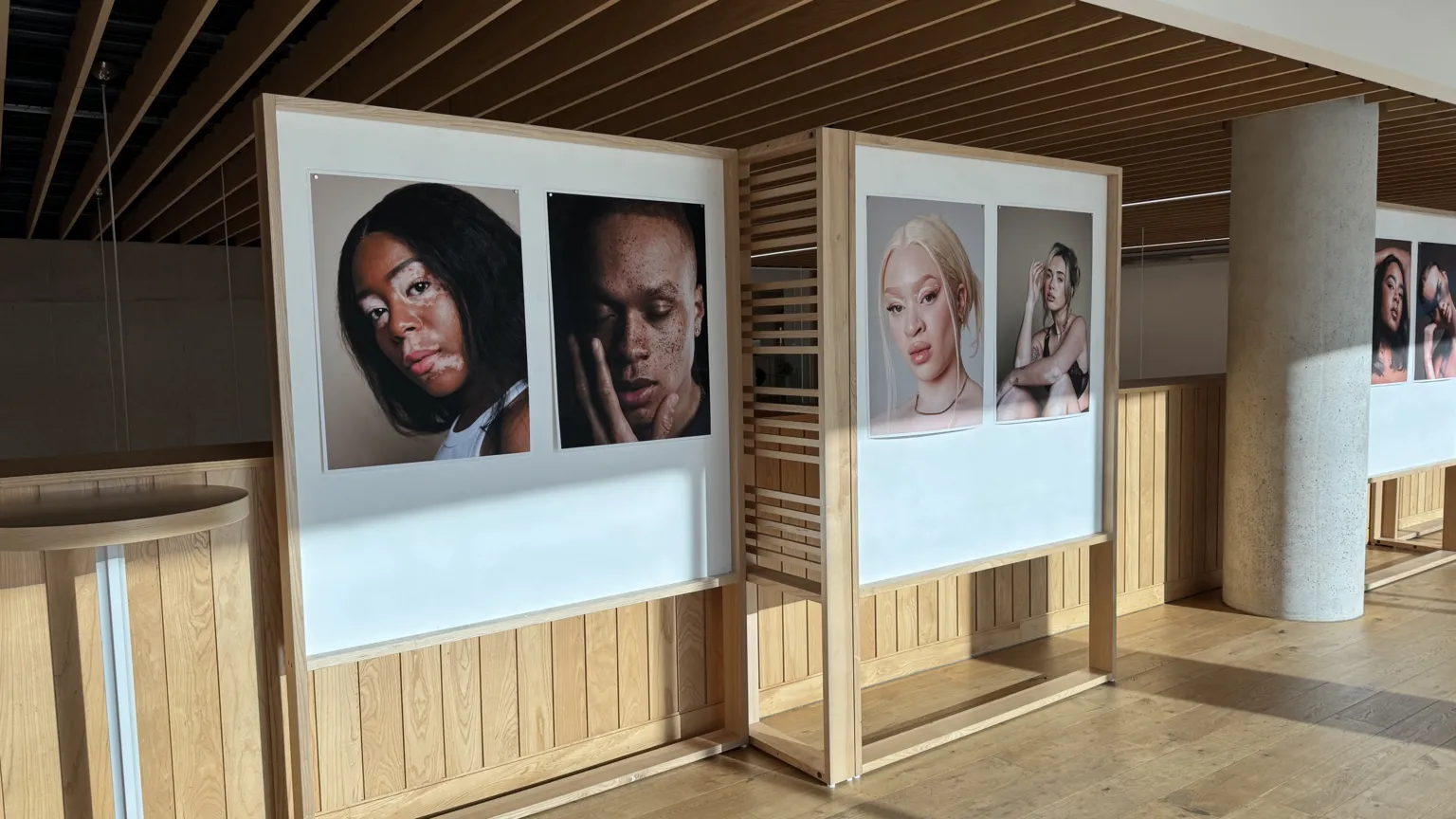 Birmingham disability photography show looks at unique beauty