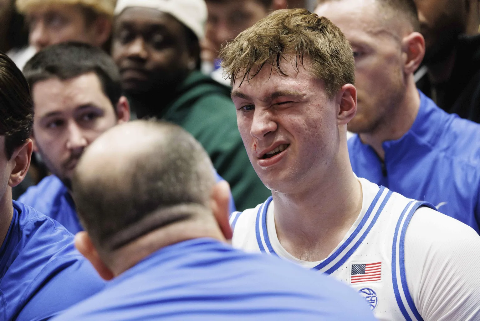 Cooper Flagg returns for 2nd half after leaving No. 2 Duke’s victory with eye injury
