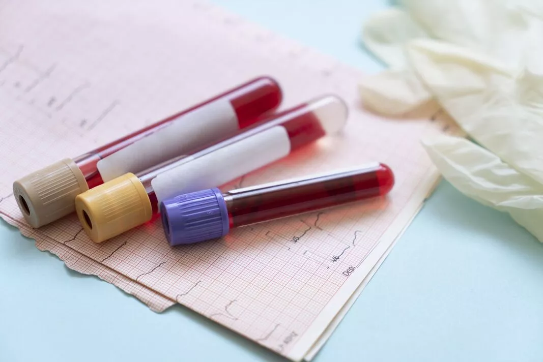 Blood test for over 50 cancers 'could be available on NHS next year'